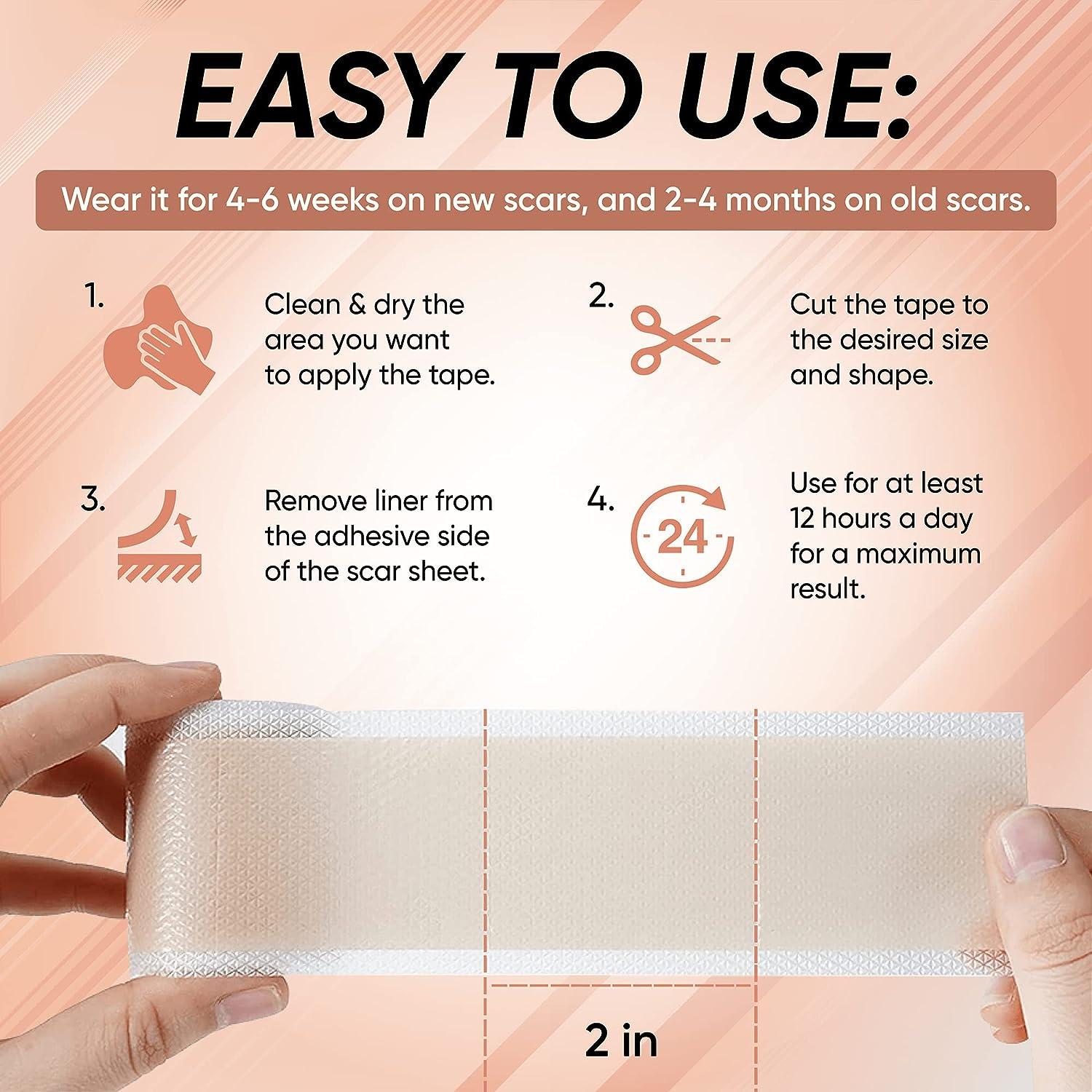 Advanced Silicone Scar Sheets with Allantoin and Onion Extract 150 x