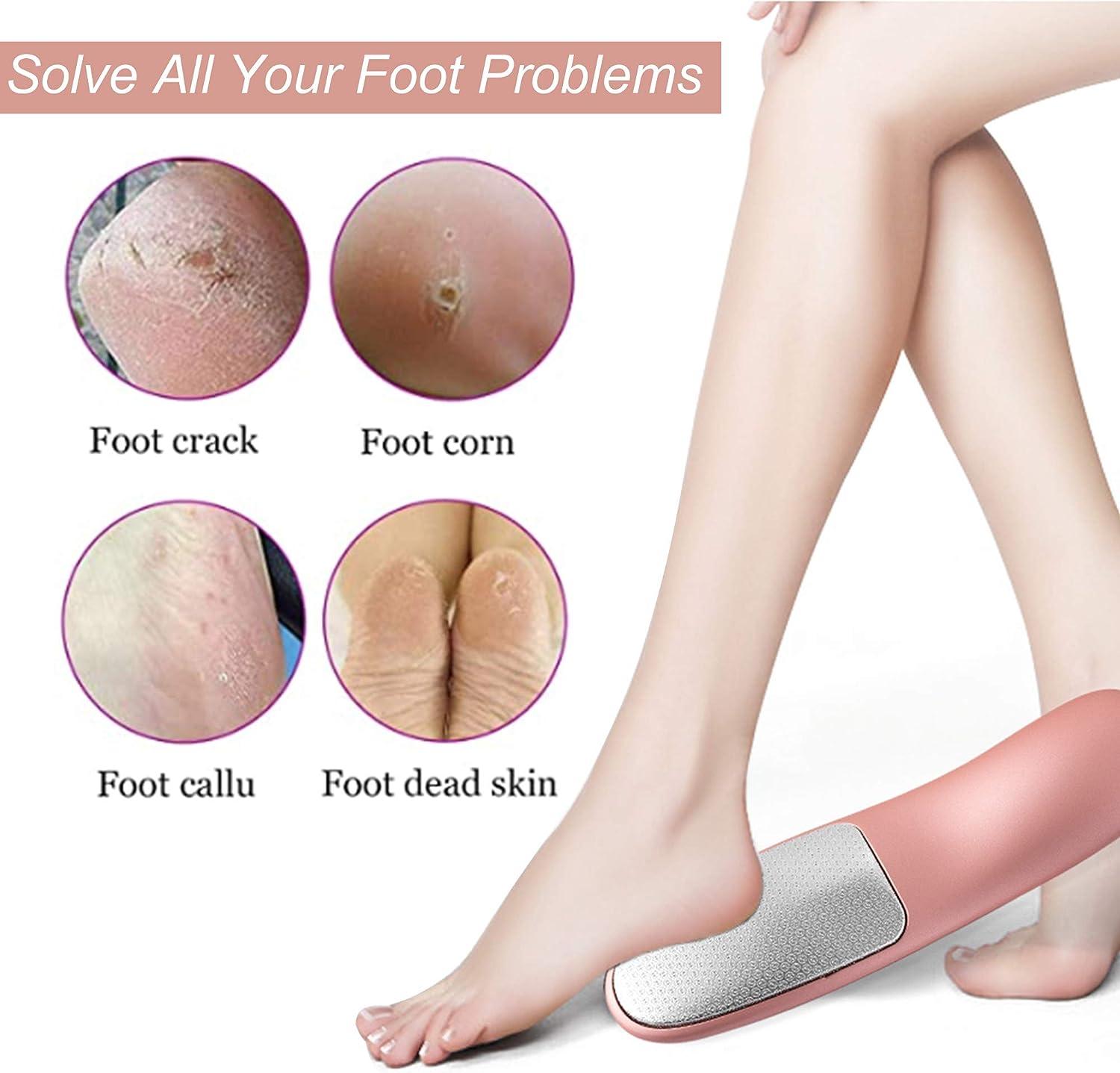 Foot File Remove Skin Foot Care Tool Callus Remover Foot Scrubberfor Removing  Dead Skin, Washing And Repairing Foot Soles, Removing Calluses And Dead Skin  On The Feet, Scraping The Heels, And Grinding
