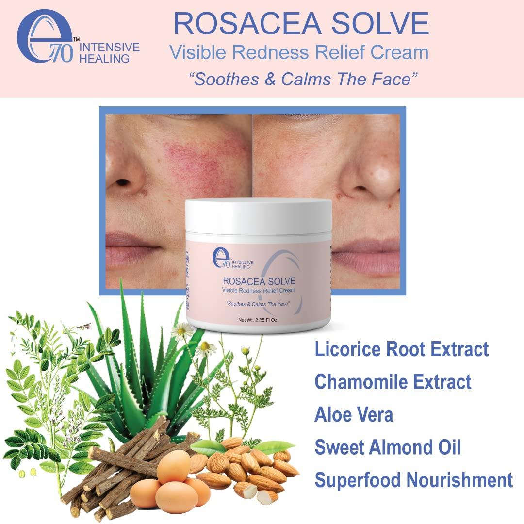 Rosacea Solve Redness Relief Cream Calming Face Moisturizer for Sensitive Skin Organic