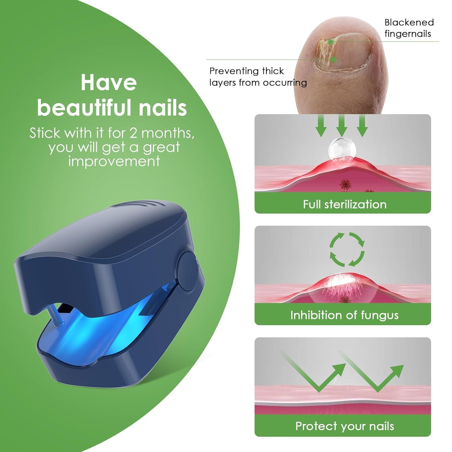 Nail Fungus Laser Device for Home Use LED Light Blue Light Therapy