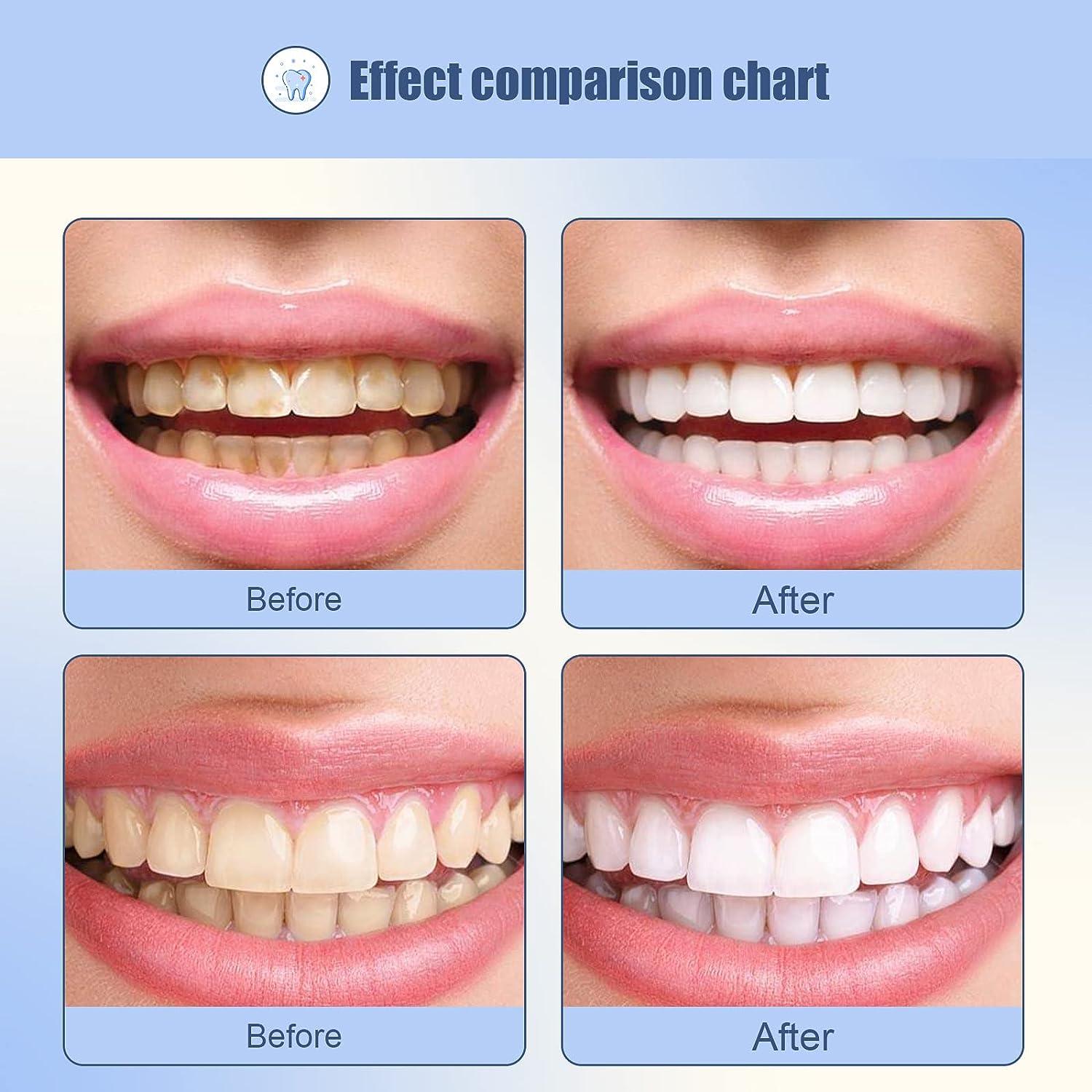 Tooth Repair Kit Temporary Natural Shade Fake Teeth Filling The Gap
