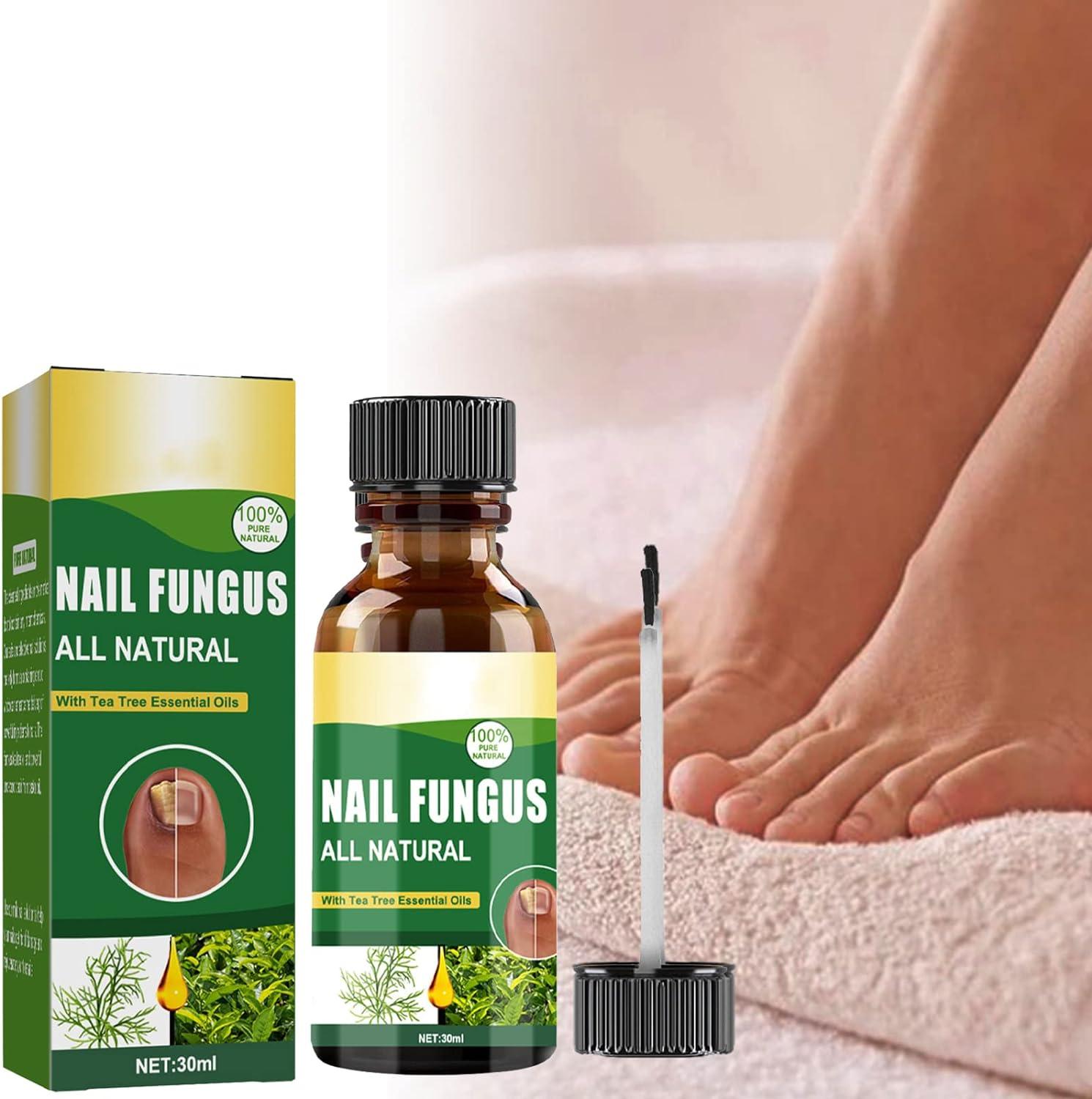 Nail Fungus Solution Anti Fungal Care Solution Nail Fungal Liquid Antifungal Liquid Fungal Nail