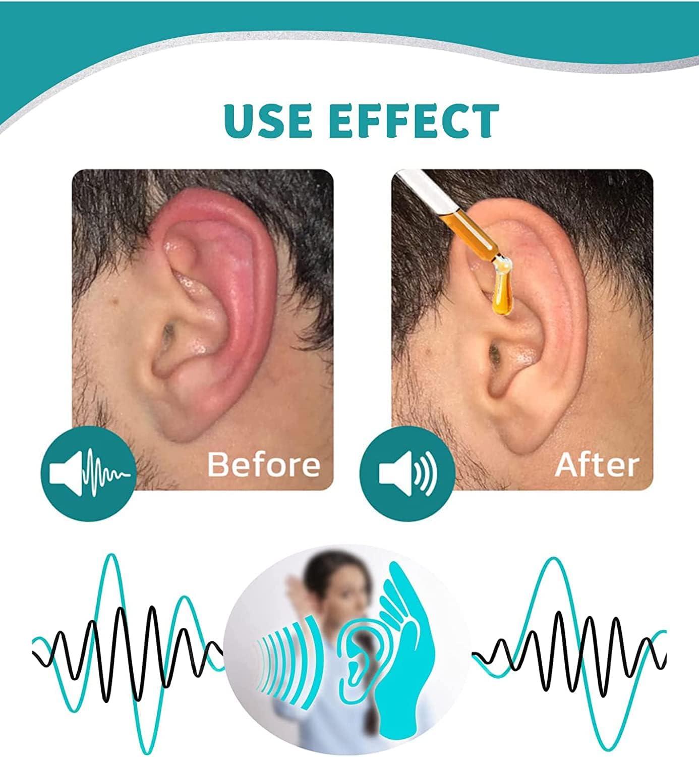 Japanese Herbal Ear Ringing Treatment Oil All Natural Remedy for Ear