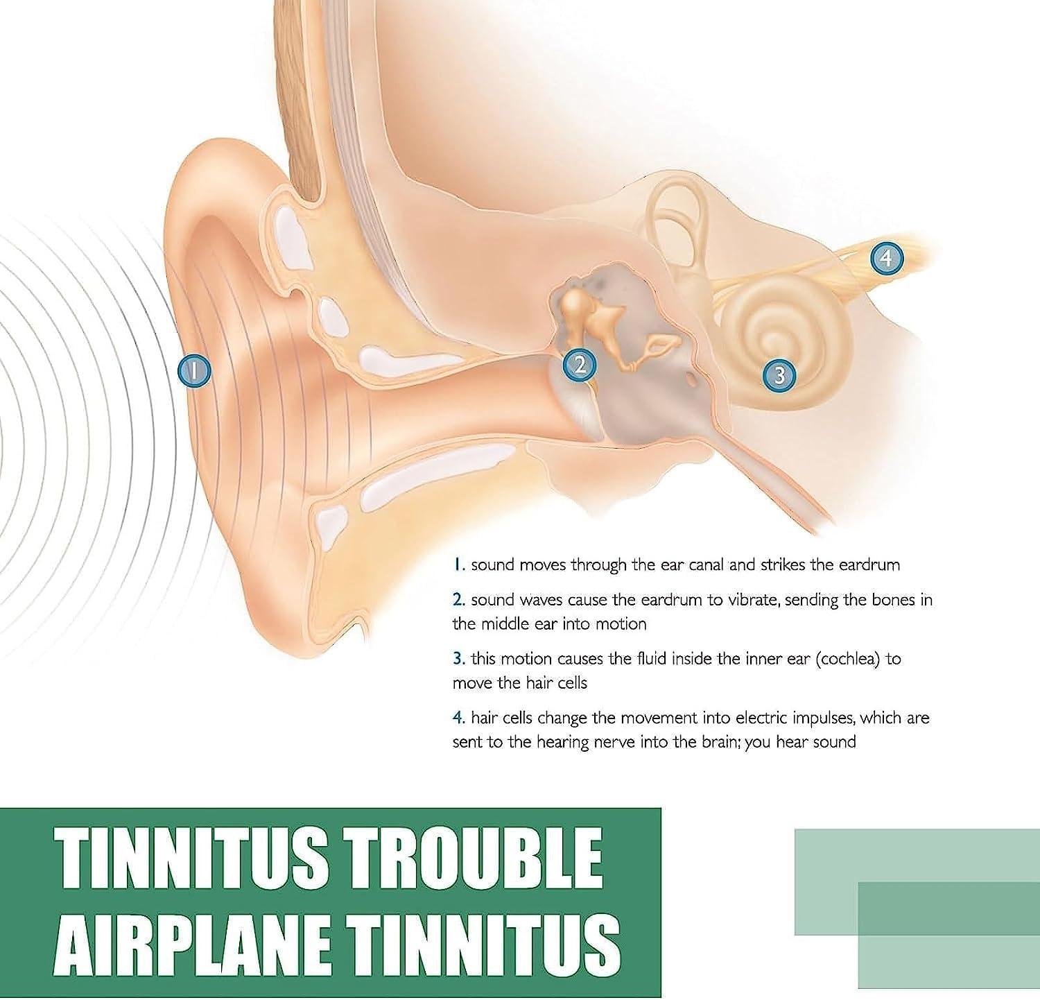 Inner Ear What Is The High Pitched Sound In My Ear Eustachian Tube What Causes High Pitch Ringing In Your Ears