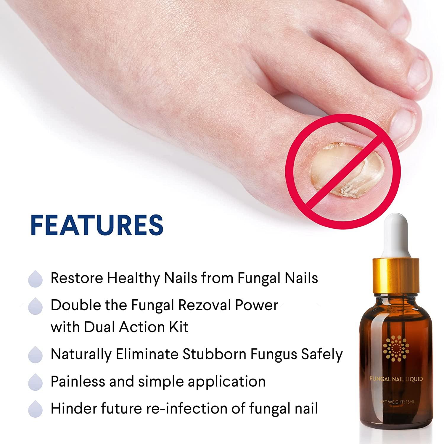 Natural Heals Nail Fungus Treatment Kit Liquid & Cream for Healthy Toenails Repair Fungal