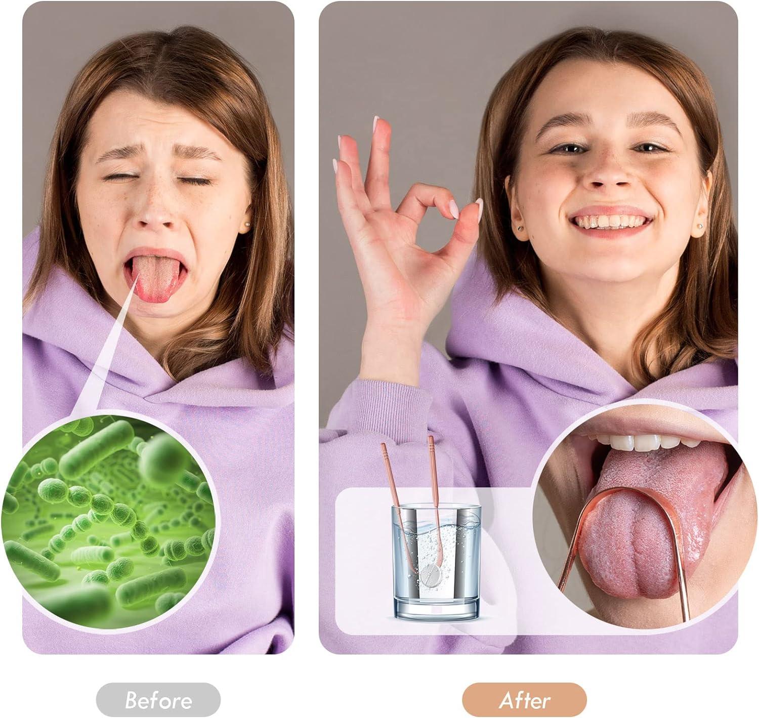 JUIDINTO Tongue Scraper Cleaner 2 Pack Medical Grade 100 Stainless