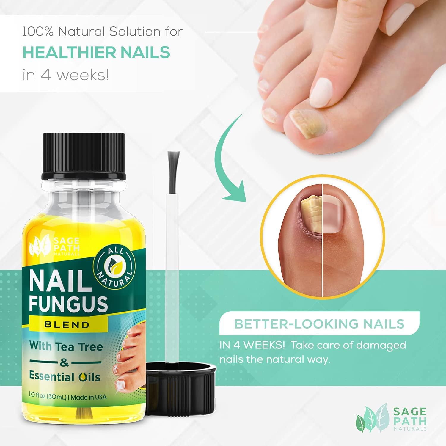 Toenail Fungus Treatment: Premium Tea Tree & Essential Oil Blend - USA  Clean Ingredients - No Fillers - No Harsh Chemicals - Max Strength Formula  for Damaged & Discolored Toe Nails