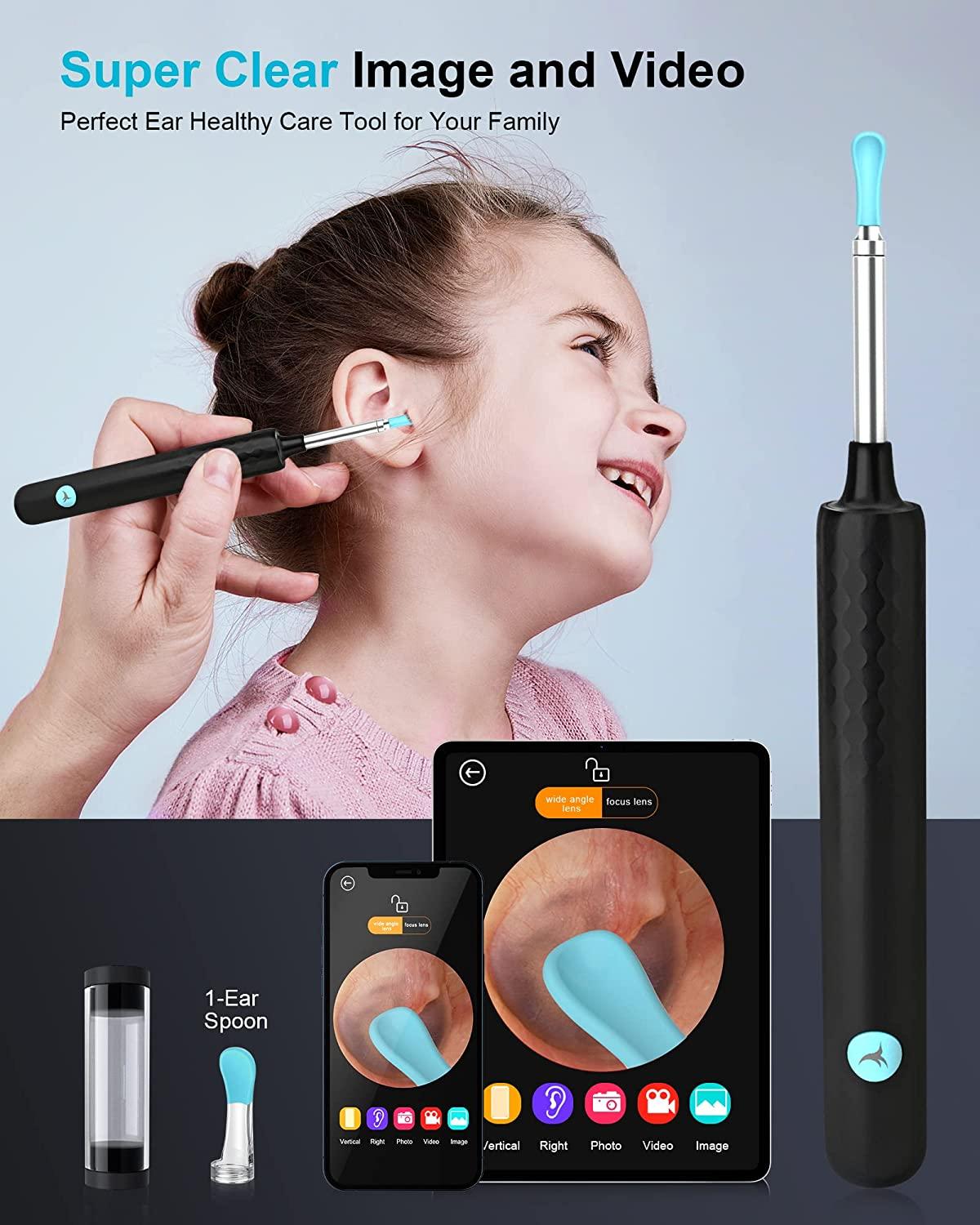 earwax removal endoscope