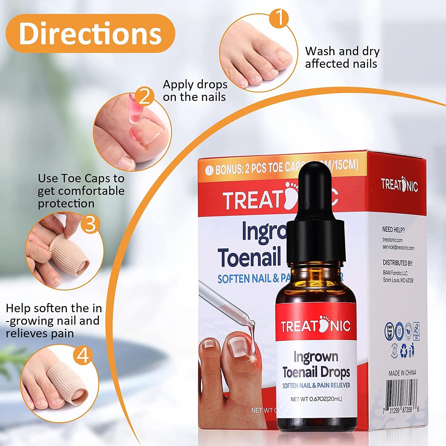 Treatonic Ingrown Toenail Treatment Kit Pain Relief & Softener with