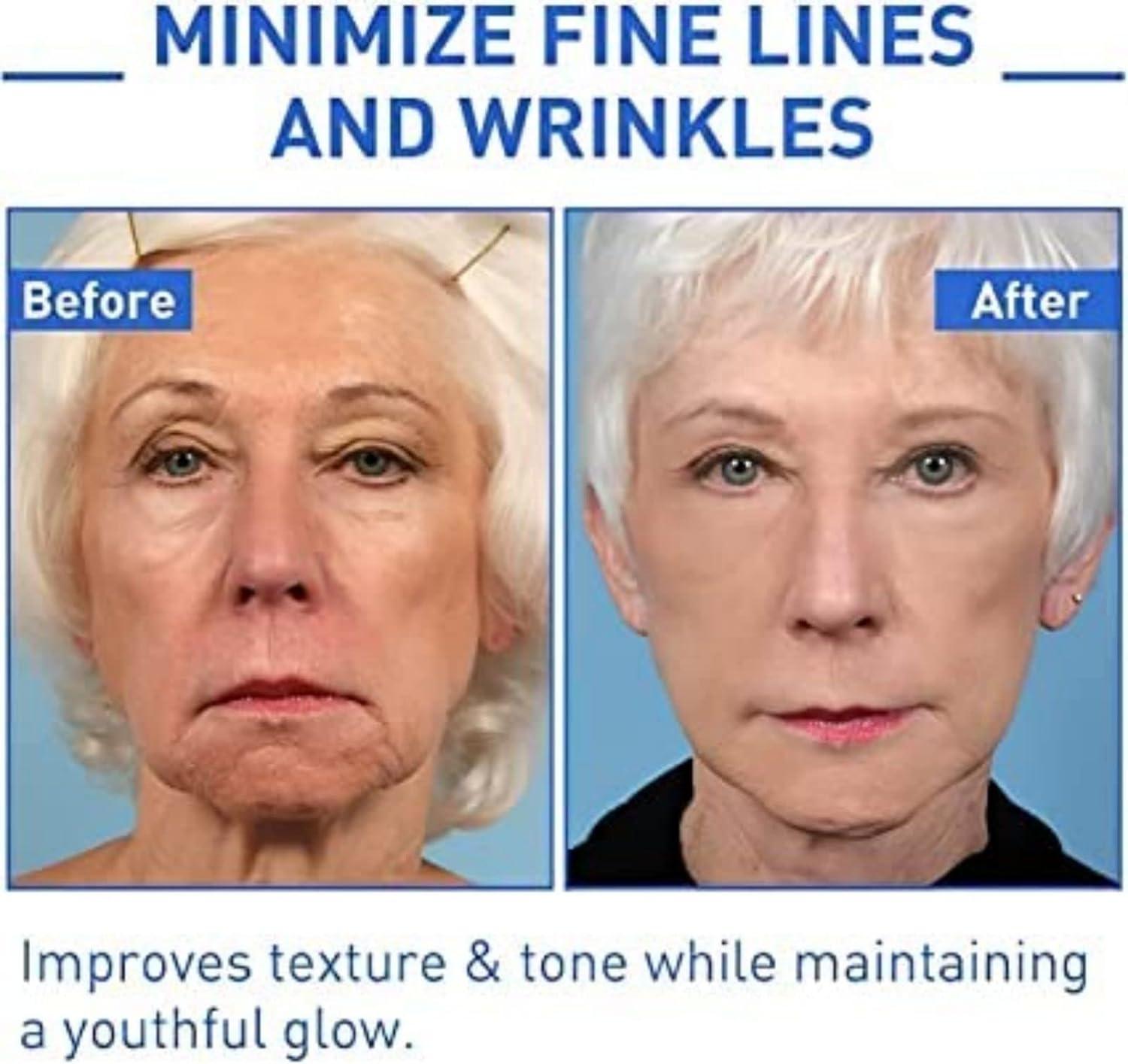 Botox in a Bottle Serum | Anti-Aging Facial Solution | Youthfully ...