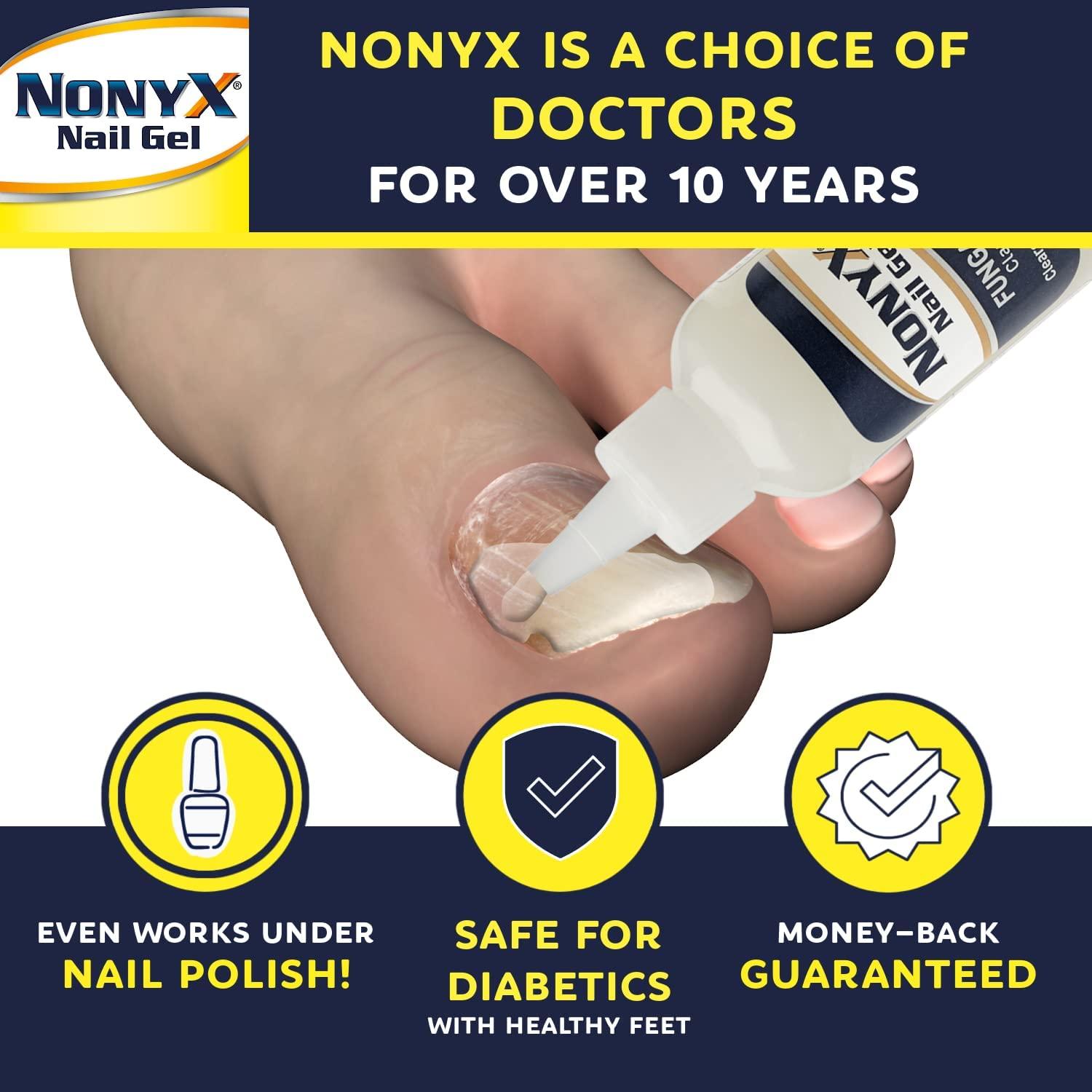 nonyx-nail-gel-a-toenail-fungus-treatment-that-clears-out-fungus-by