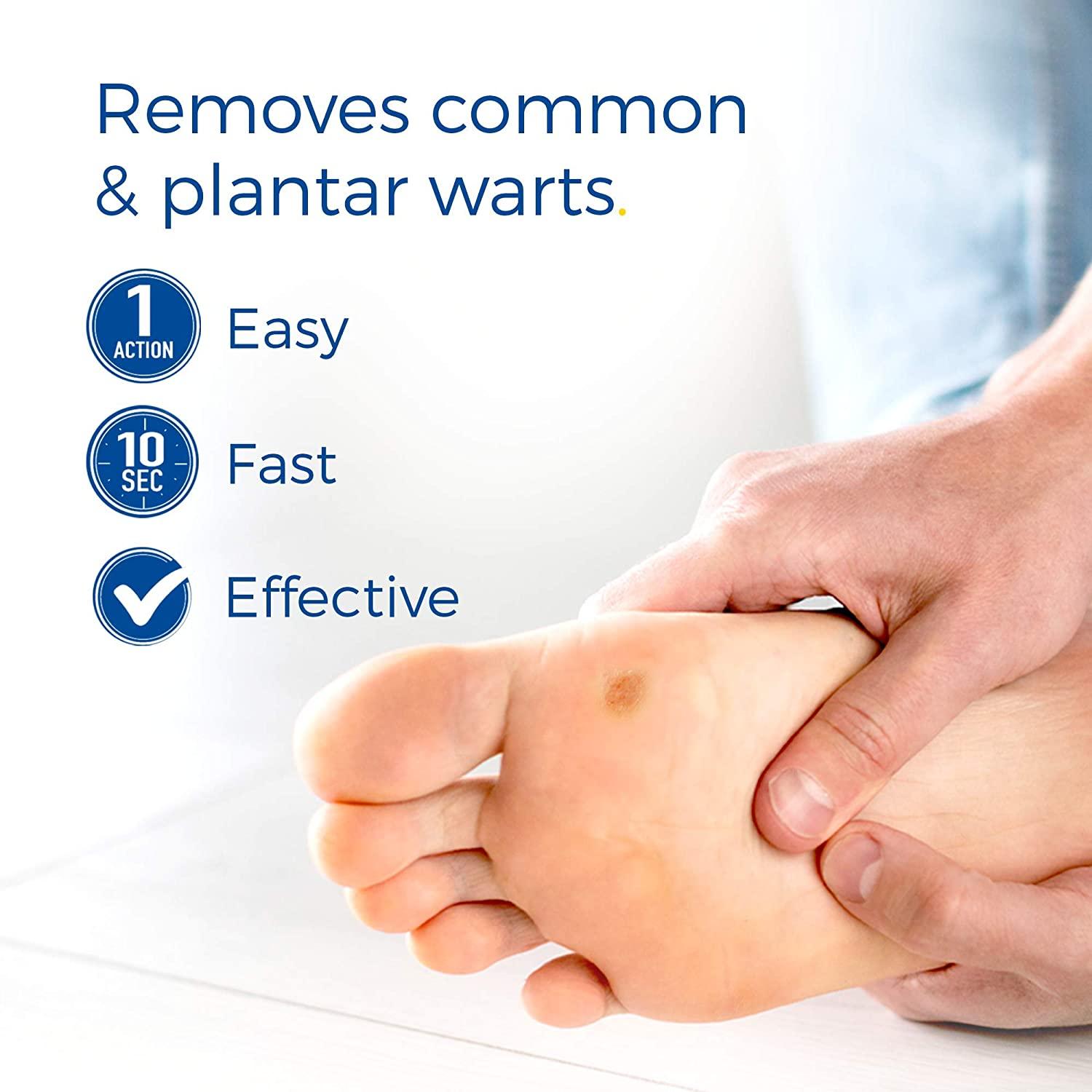 Freeze Away MAX® Plantar Wart Remover | Dr. Scholl's