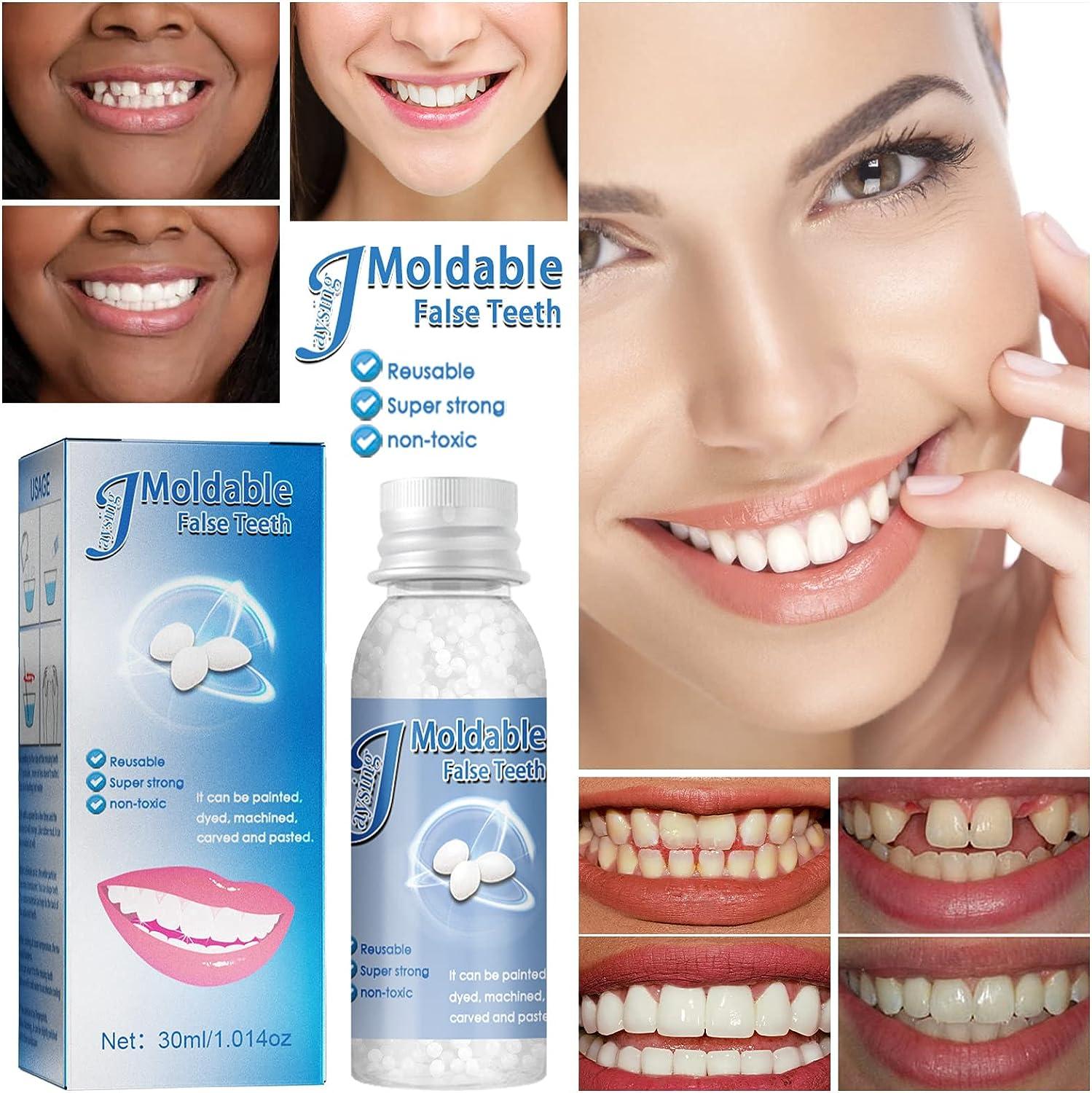 Tooth Repair Beads Kit, 30ml Moldable Thermal Fitting Beads Temporary