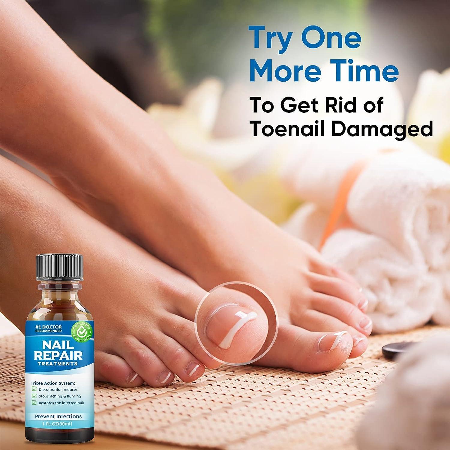 Natural Nail Repair Solution for Damaged, Cracked, and Discolored Nails