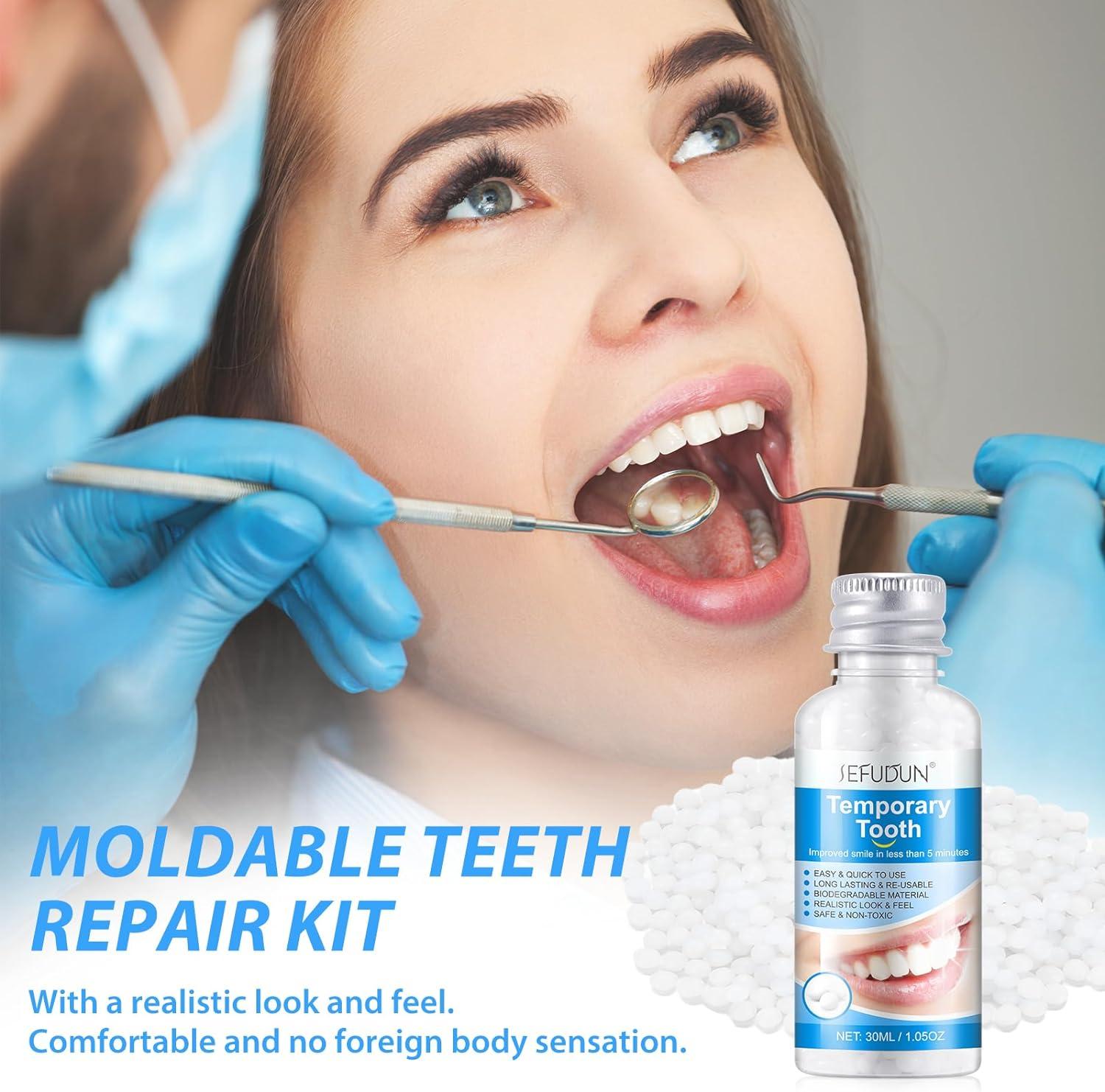 Temporary tooth filling kit with tweezers 2 30ml shortterm tooth