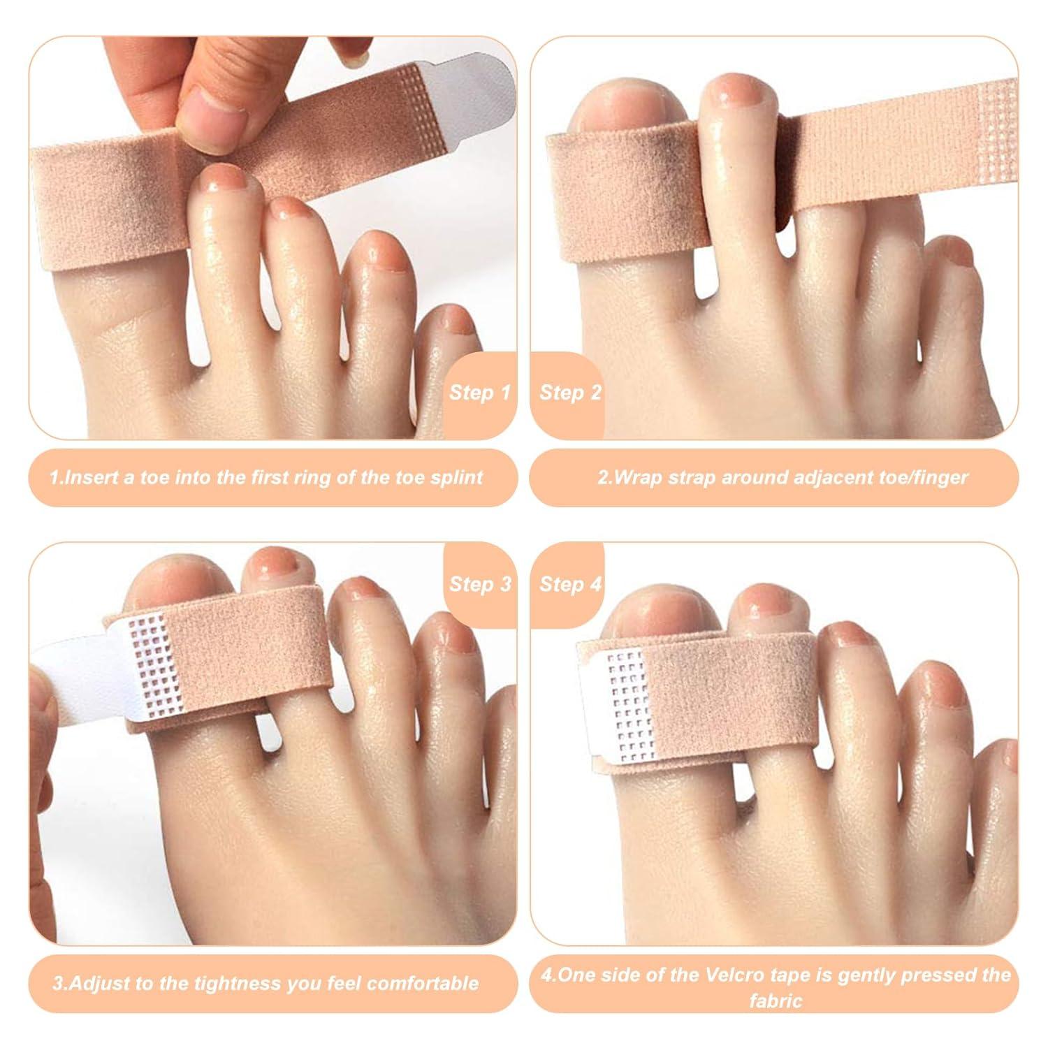 20Pcs Finger Buddy Wraps Finger Splints Tape Hammer Toe Straightener Adjustable Breathable Brace