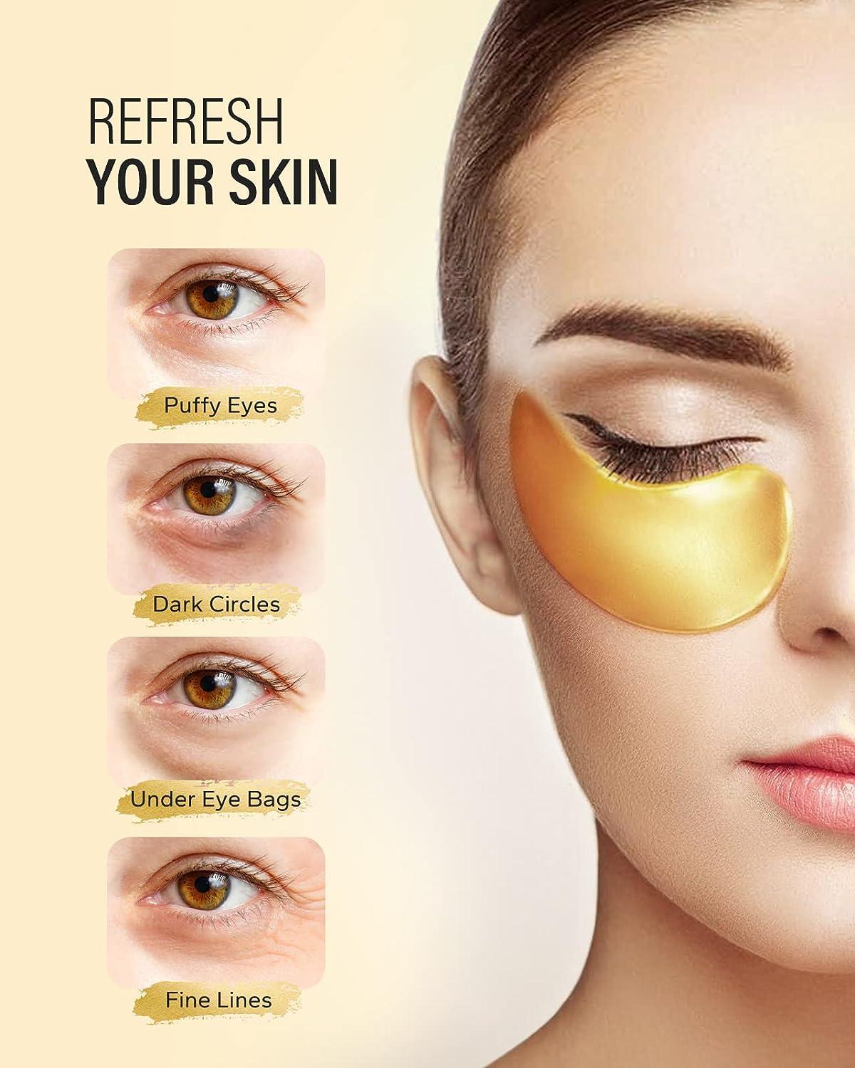 Yellow circles sales under eyes