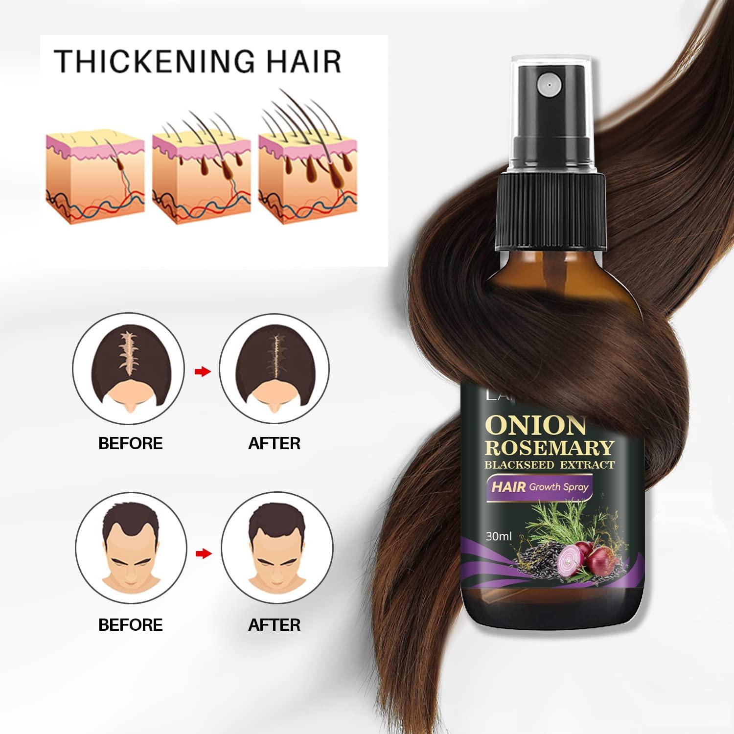 Hair Growth Spray Onion Oil for Hair Growth Organic Hair Growth Serum Enriched with Rosemary
