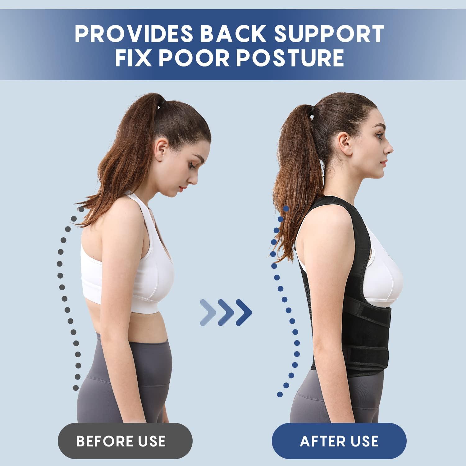 Suptrust Back Brace Posture Corrector for Women and Men Back