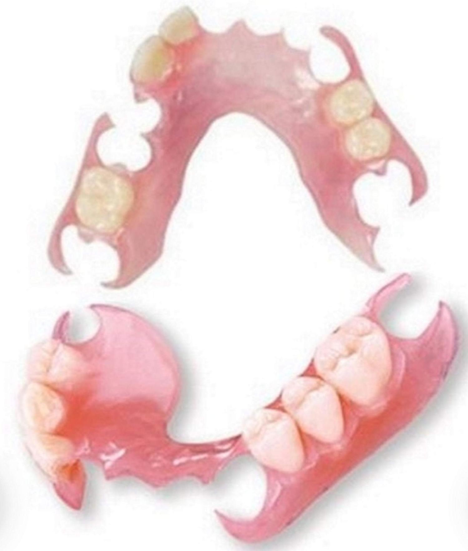 Affordable Flexible Valplast Customized Partial Denture (Pink, Valplast