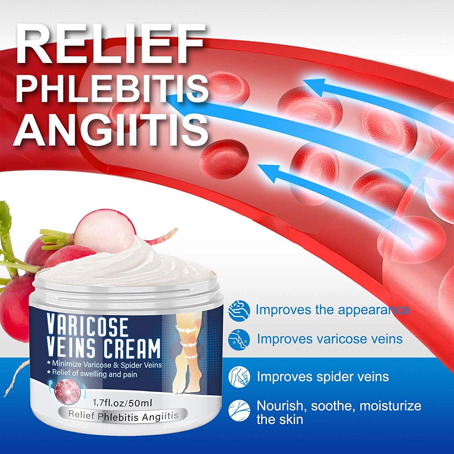 Varicose Veins Cream, Veins Treatment Cream for Legs, Natural Extract