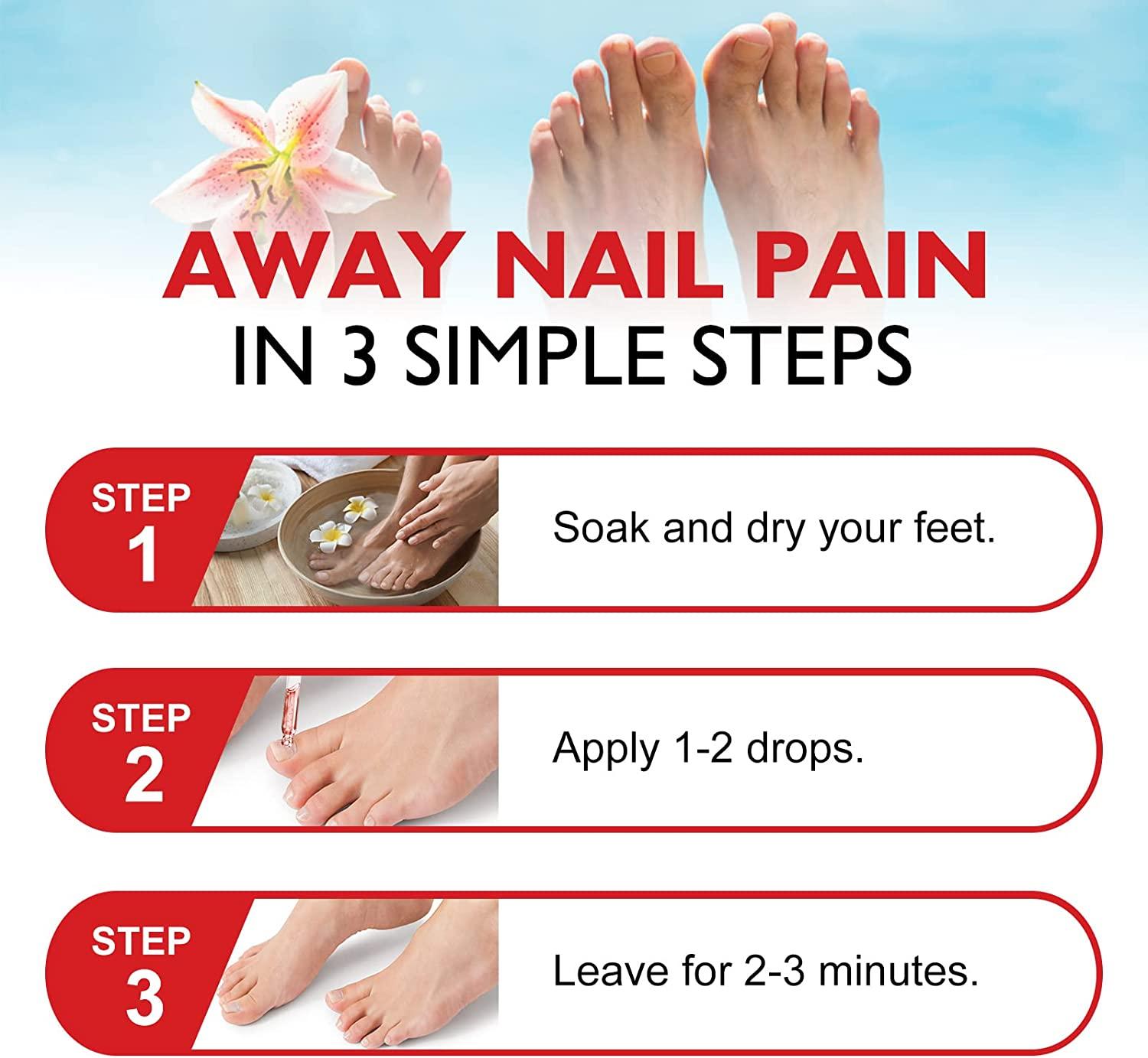 Natural Ingrown Toenail Treatment & Pain Relief Drops 30ml (1 bottle)