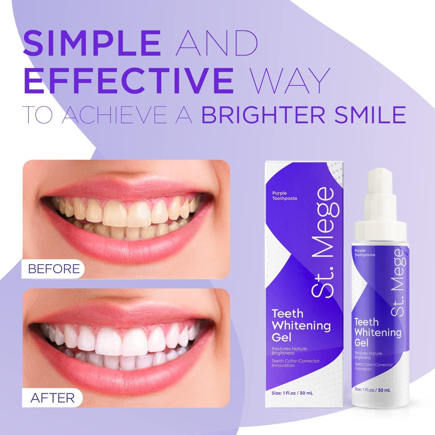 St. Mege Purple Toothpaste Teeth Whitening Gel with Color Wheel