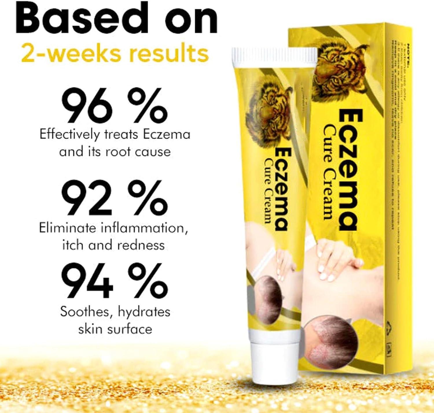 Eczema and Psoriasis Relief Cream Set Soothes Irritated Skin, Treats