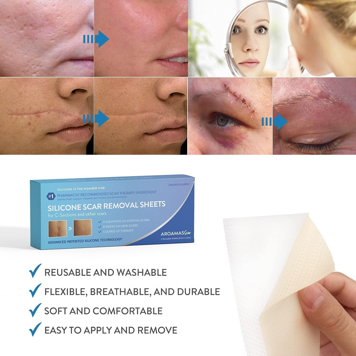 Aroamas Professional Silicone Scar Removal Sheets for Scars Caused by CSection, Surgery, Burn