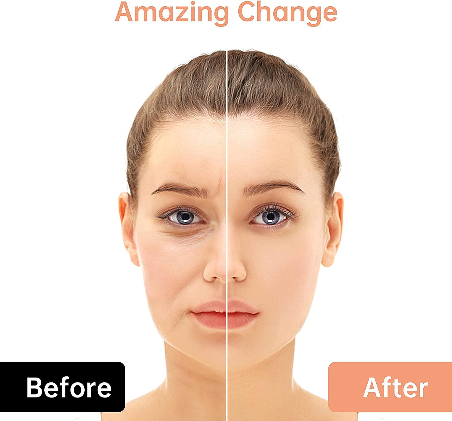 2 in 1 Electric Face Massager 3D Roller and T Shape Kit for Anti