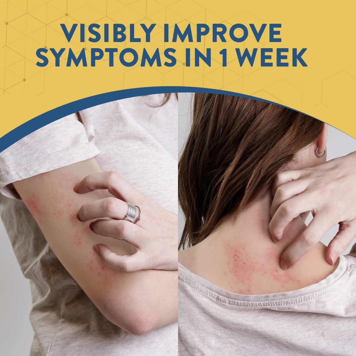 Oheal Shingles Pain Relief Cream 3.4OZ White Soothing Treatment for