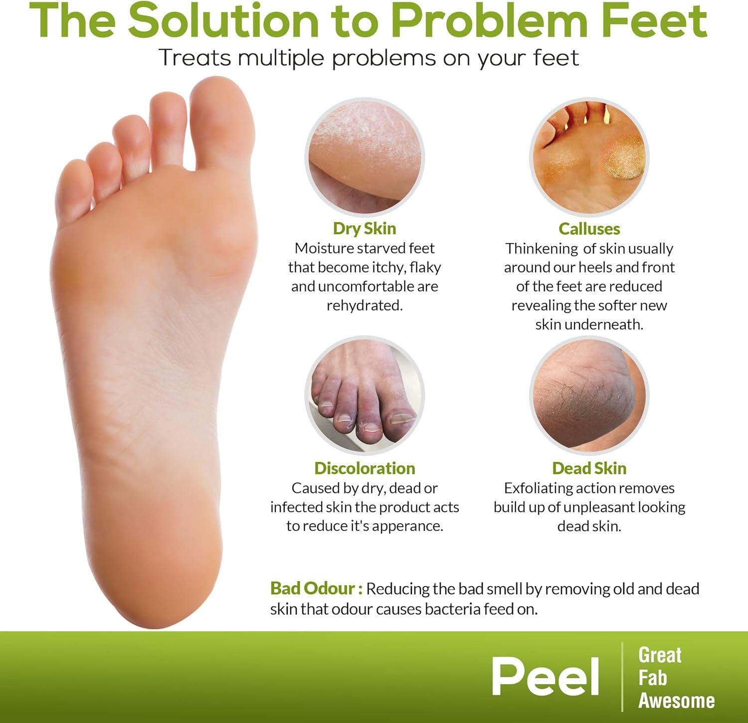 FEELGUD Pack Plant Based Exfoliating Foot Peel Mask for Hard