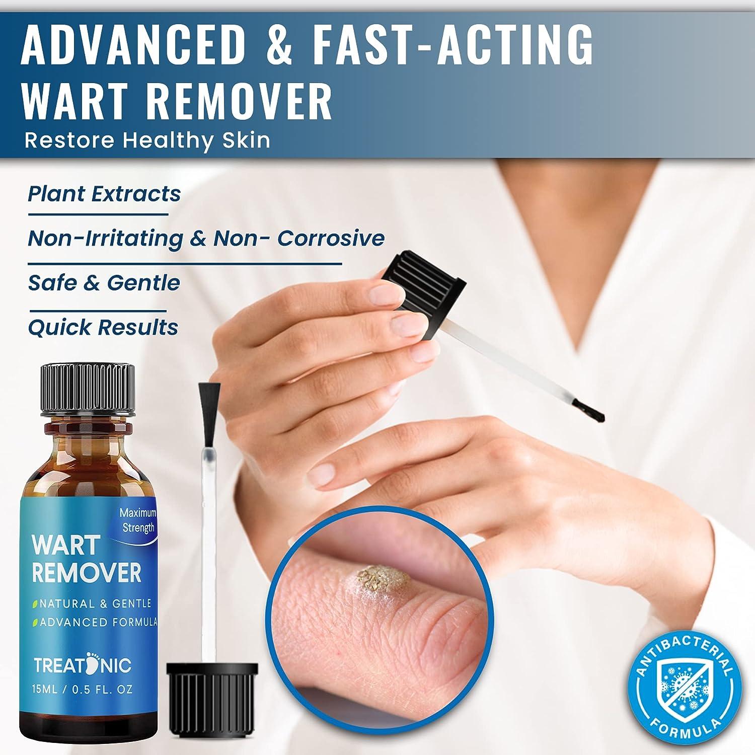 Treatonic Wart Remover Gel - Fast Acting Plantar Wart Removal for Feet ...
