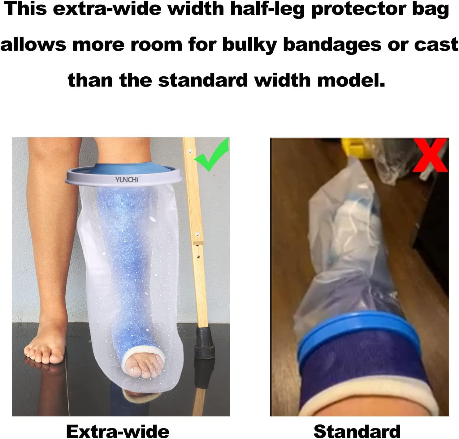 YUNCHI Upgraded Extra Wide Full Leg Cast Cover for Shower after Knee  Surgeries with Non-Slip Bottom for Leg Wounds, Bandage, Large Cast, Knee  Immobilizer/Brace, Walking Boots, Reusable - Yahoo Shopping
