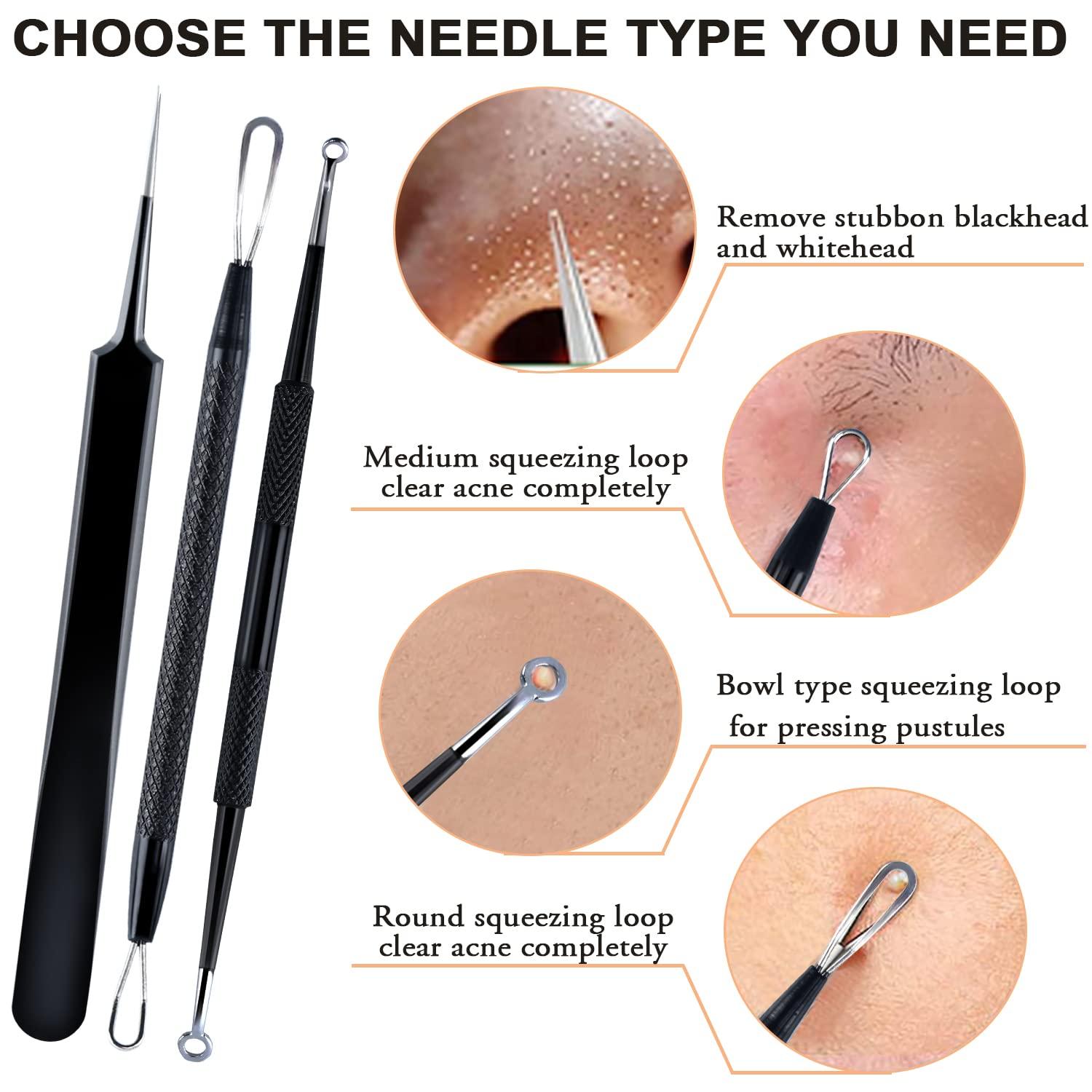 Huge Blackhead Removal Videos - vi8l7uc