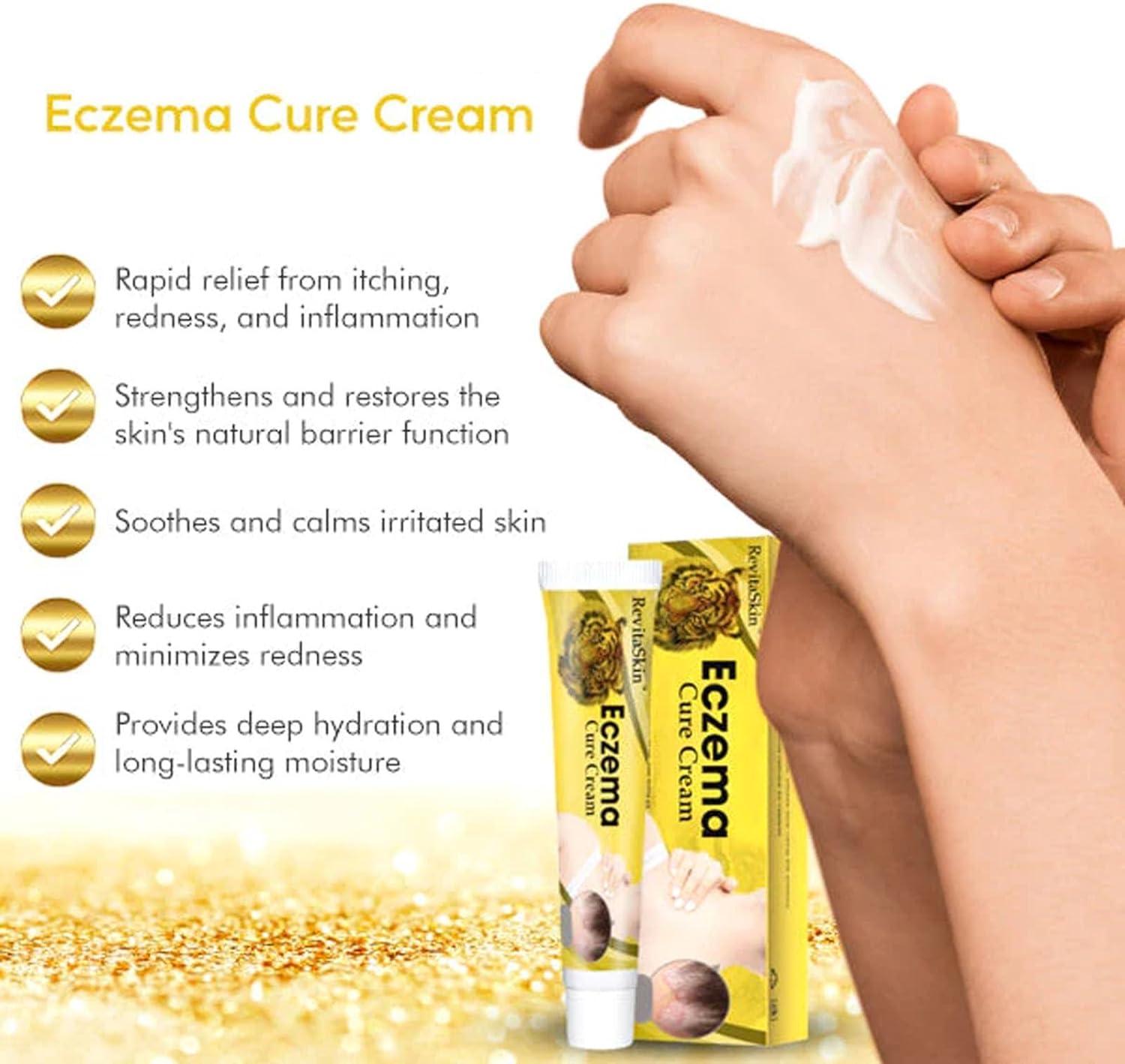 Eczema and Psoriasis Relief Cream Set Soothes Irritated Skin, Treats