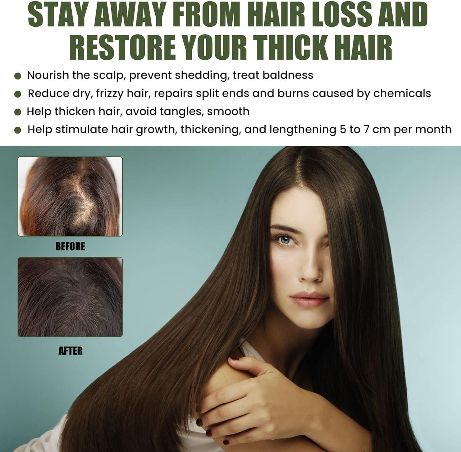 Blusoms Hair Growth Serum Spray with Ashwagandha 4500 100ML