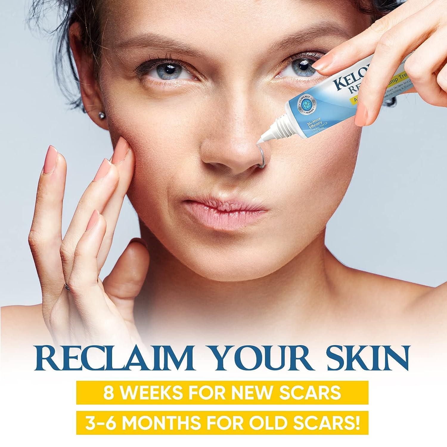 Keloid Bump Removal Keloid Scar Treatment for Nose & Ear & Belly