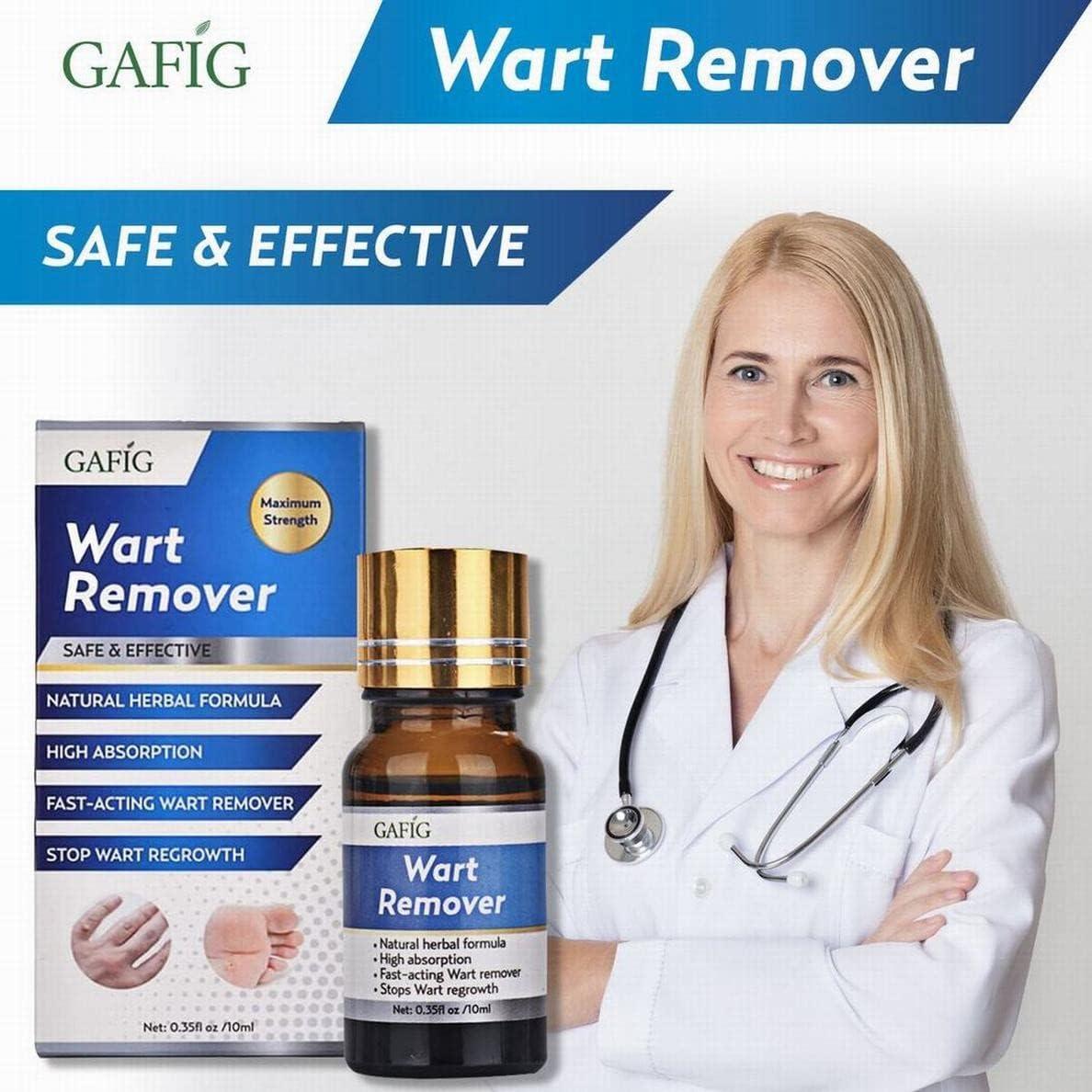 Gafig Wart Remover Painlessly Removes Common Hand and Plantar Wart