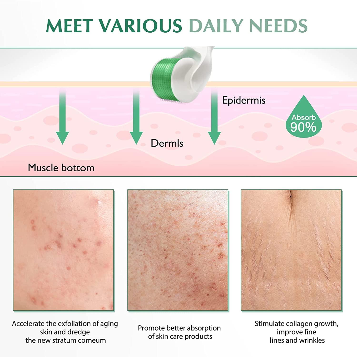 Derma Roller Skin Dermaroller Microneedle Skin Rollers Micro Needle