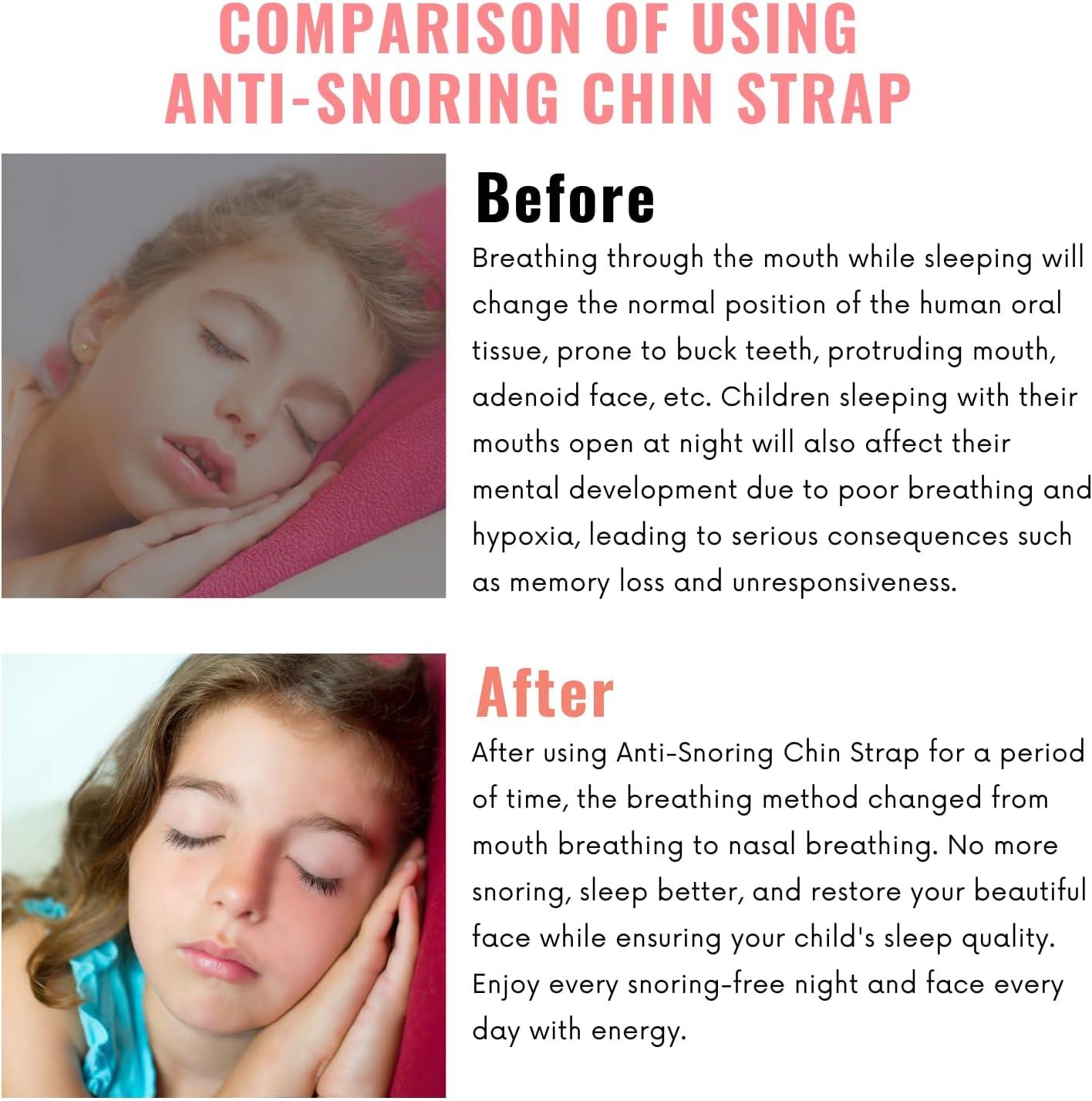 Orapink Anti-Snoring Chin Strap Children Chin Strap for Snoring