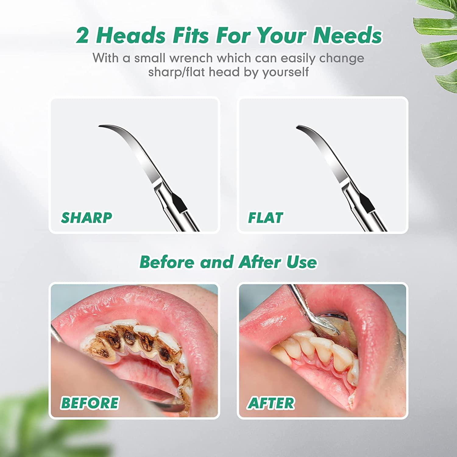 Electric Rechargeable Plaque Remover for Teeth,Teeth Cleaning Kit with