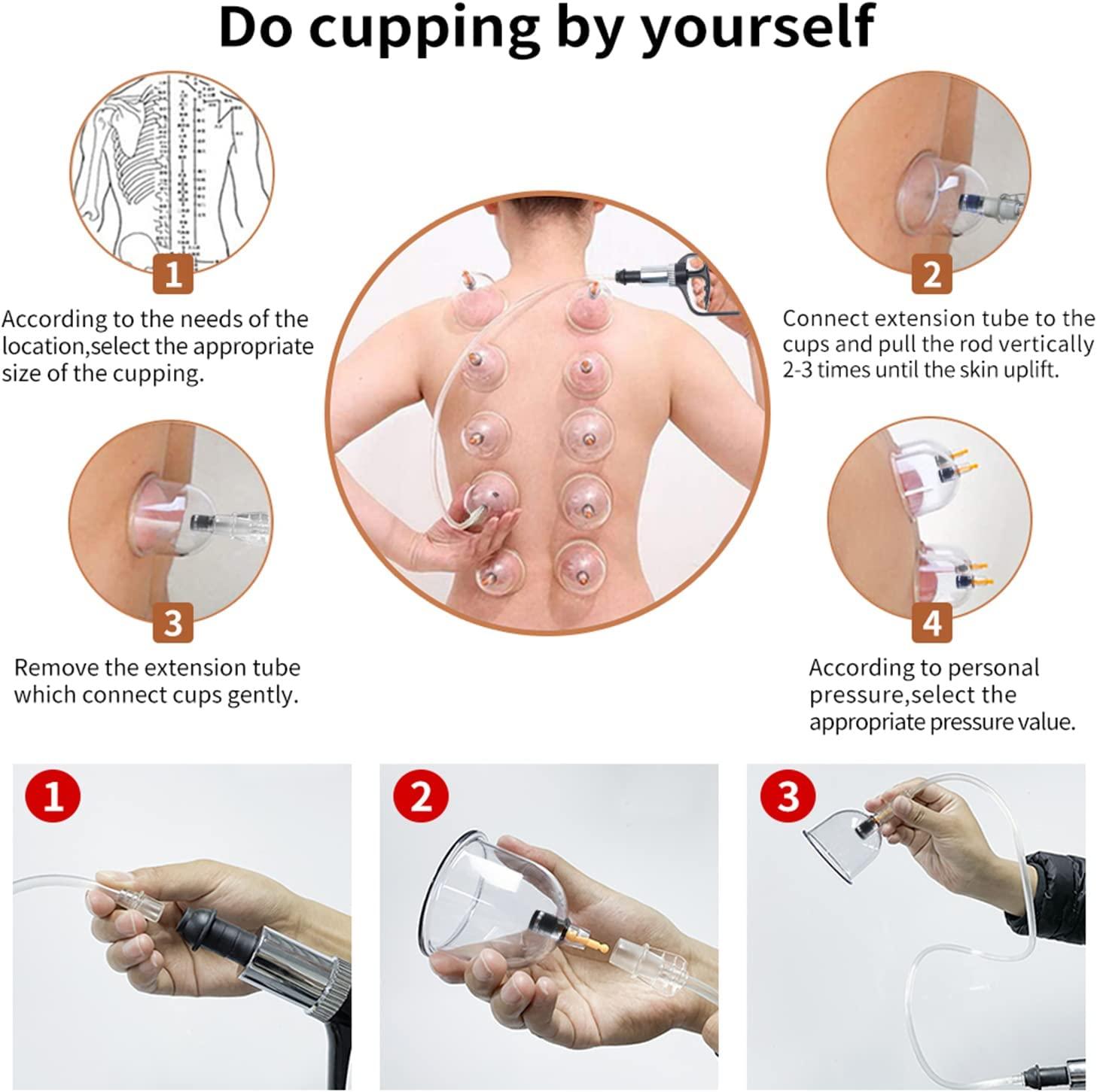 Cupping Therapy Set,32 Therapy Cups Cupping Set with Pump, Professional