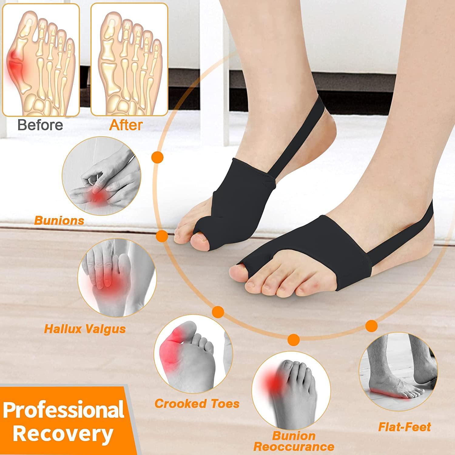 Bunion Corrector for Women & Men NonSurgical Bunion Splints with Toe Separators Effective