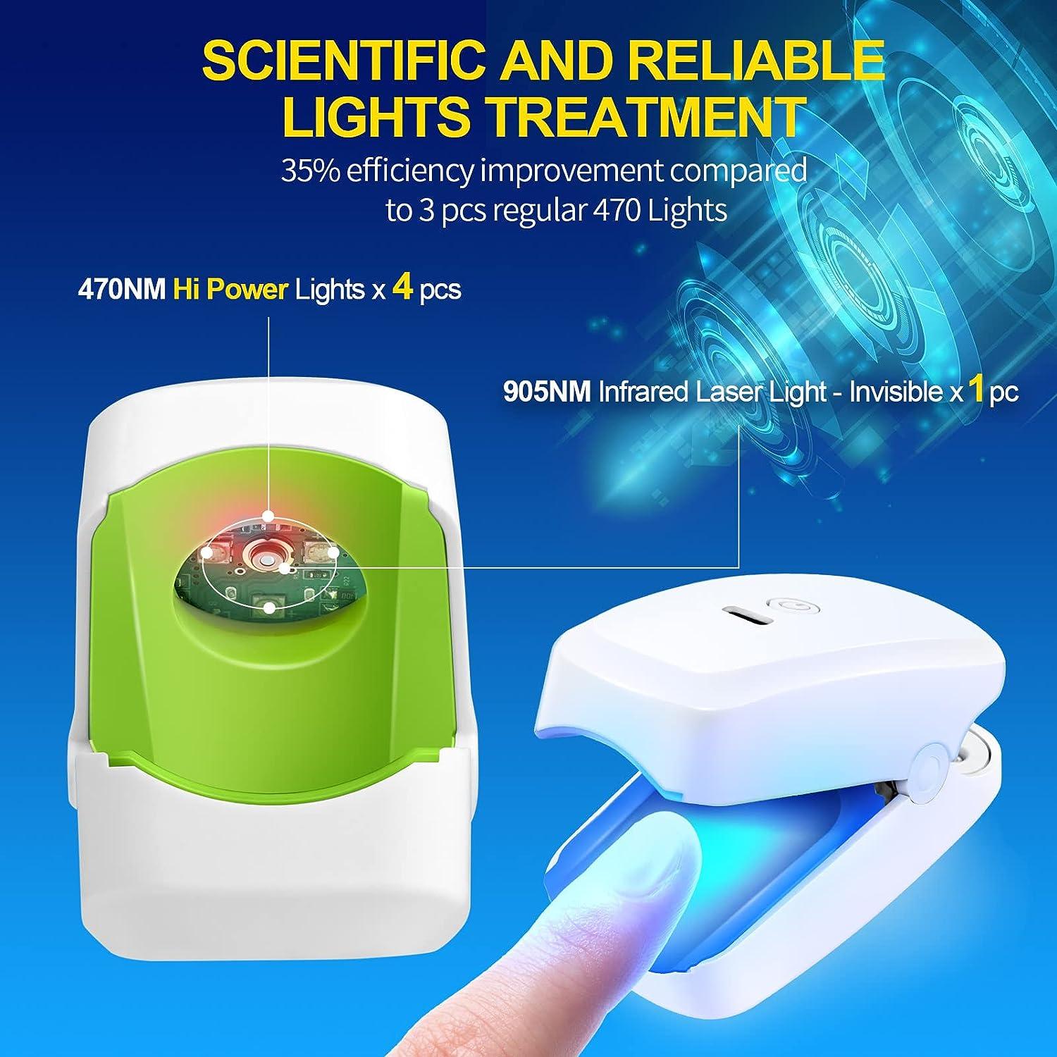 Nail Fungus Laser Treatment Device Laser Device for Toenails Dermachom
