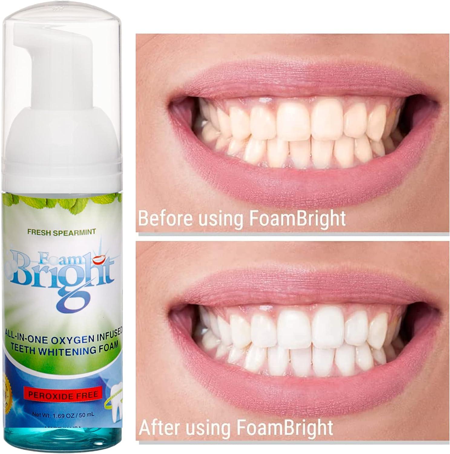 Retainer Foam Cleaner & Teeth Whitening Formula. The Ultimate Cleaning