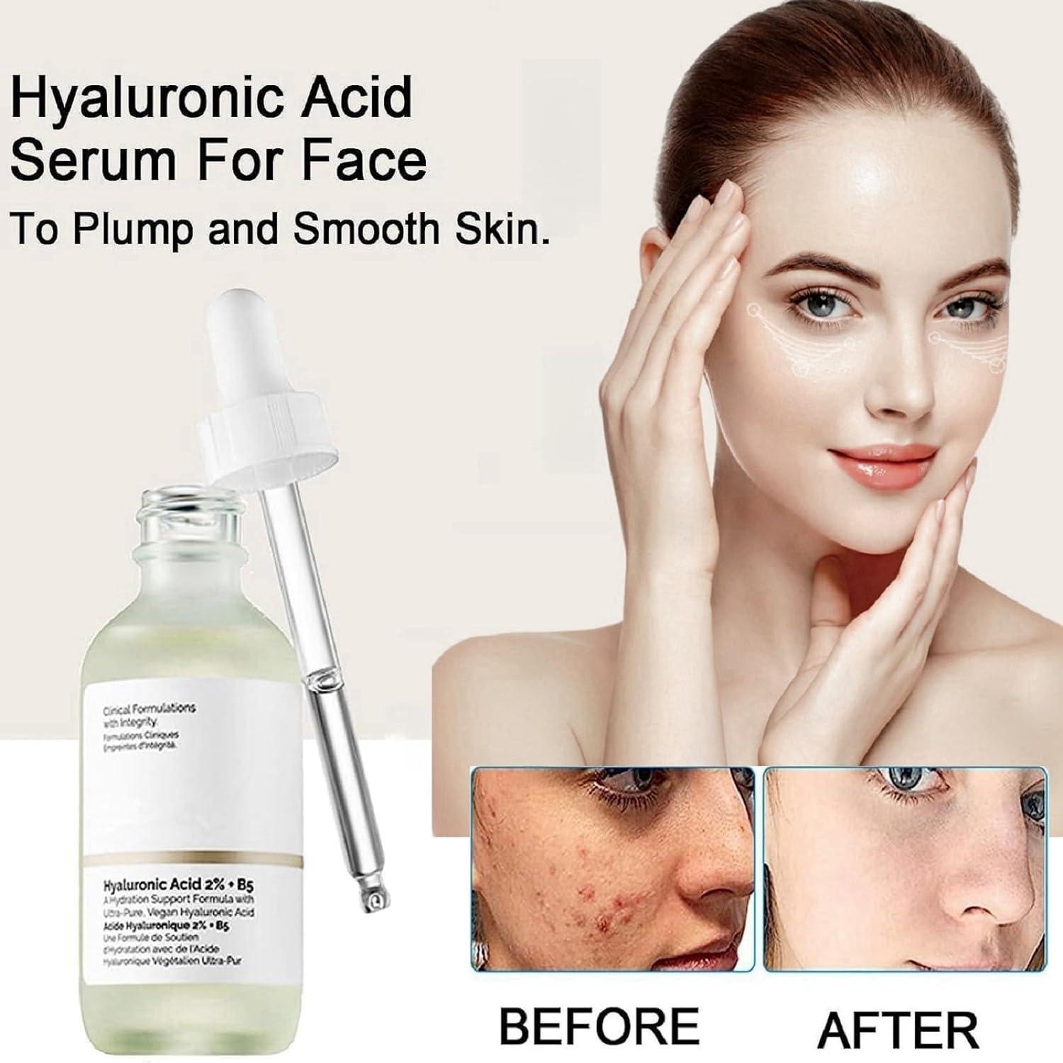 Hyaluronic Acid 2+B5 30ml Face Serum Dark Spot Remover for Face Hyaluronic Acid Serum