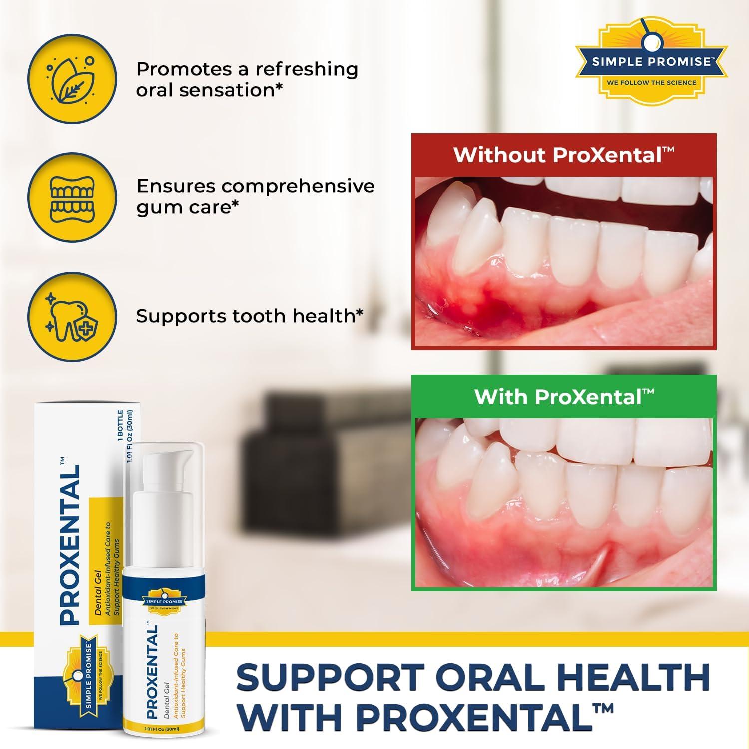 ProXental Dental Gel - Xylitol & Aloe Vera Oral Gum Care | Sensitive Teeth  Fresh Breath & Enamel Support - 30ml Travel Size | Buy Now with Express  International Delivery | GoSupps.com