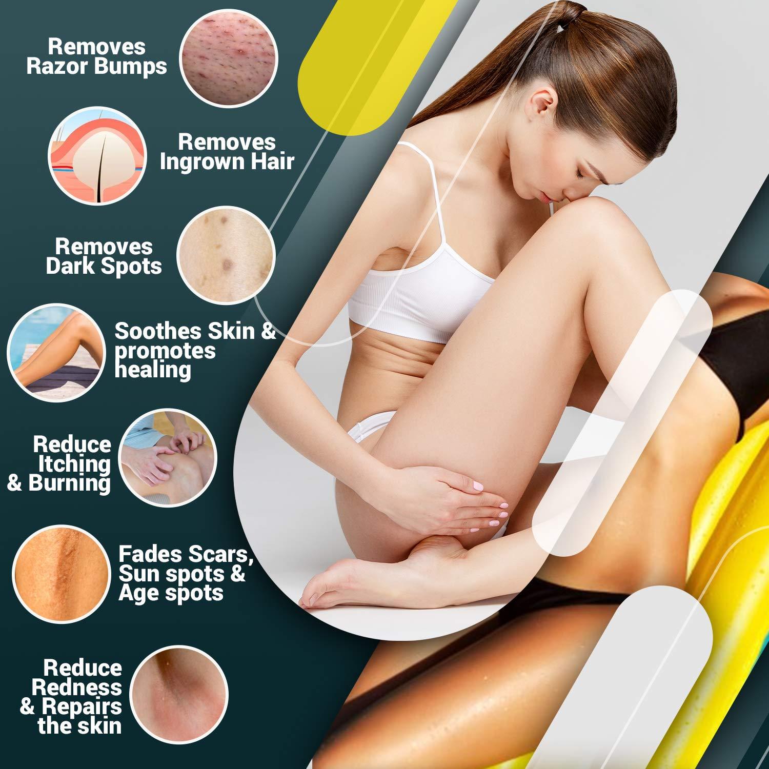 Roll On Razor Bump Treatment for Bikini Area, Legs, Underarms