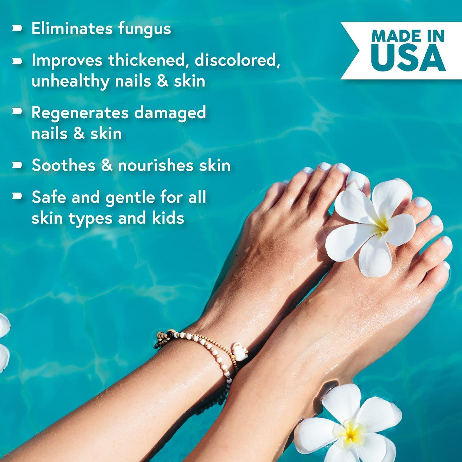 Ebanel Foot Fungus Treatment Extra Strength Athletes Foot Cream with